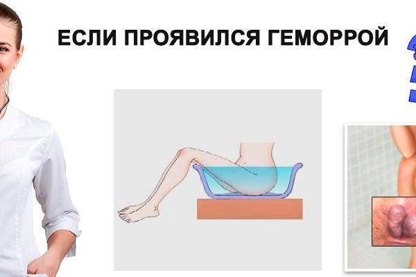 Кракен маркетплейс это
